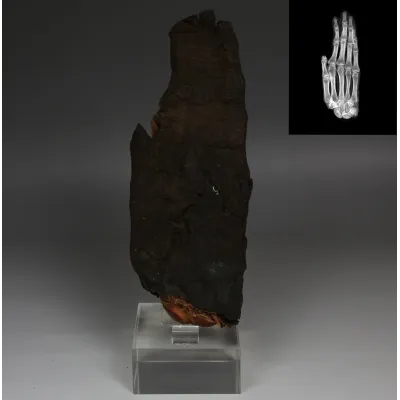 Avers, pour Égyptien — Mummified hand with X-Ray — Late Period, 664 - 332 av. J.-C., Late Period, 664 - 332 av. J.-C.